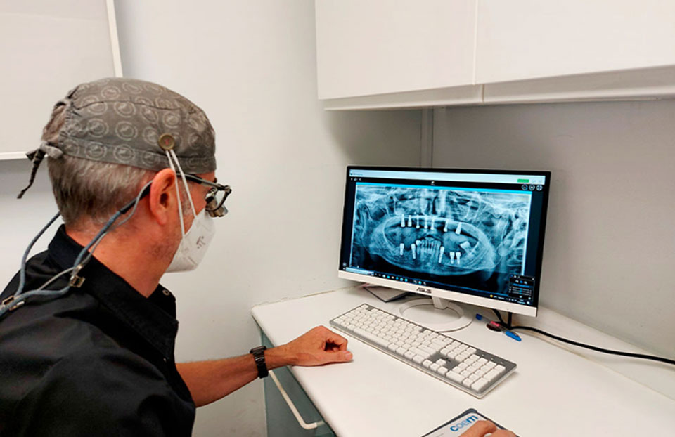 doctor Daniel Sánchez Vicario revisando radiografia implantes carga inmediata