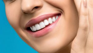 mitos del blanqueamiento dental